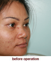 plastic_surgery_augmentation_rhinoplasty